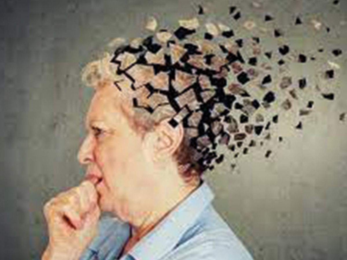 Alzheimer
